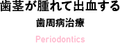 歯茎が腫れて出血する 歯周病治療 Periodontics