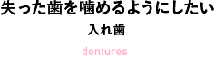 失った歯を噛めるようにしたい インプラント・入れ歯 Implant / dentures
