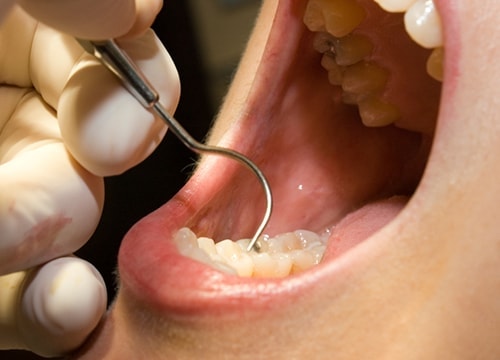 治療 イメージ画像