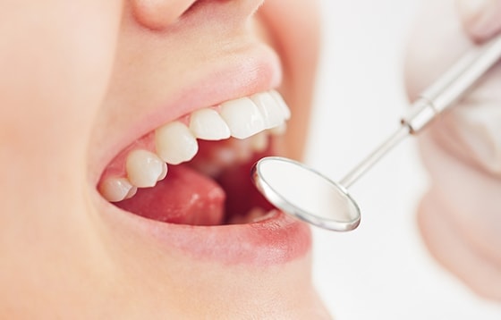 口腔内のケア イメージ画像